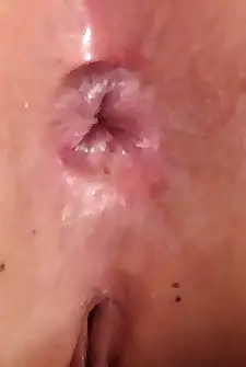 f my poor stretched asshole after wearing a plug for several hours